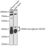 Western Blot - Anti-delta Sarcoglycan Antibody (A89255) - Antibodies.com