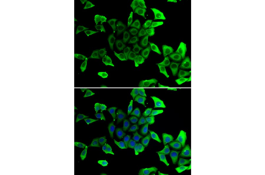 Immunofluorescence - Anti-delta Sarcoglycan Antibody (A89255) - Antibodies.com