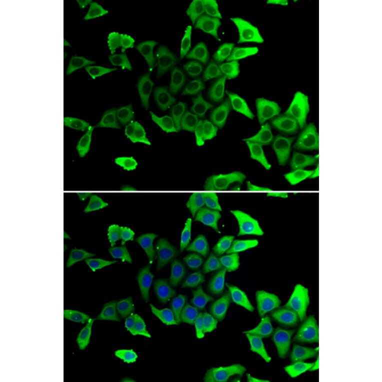 Immunofluorescence - Anti-delta Sarcoglycan Antibody (A89255) - Antibodies.com