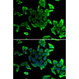 Immunofluorescence - Anti-delta Sarcoglycan Antibody (A89255) - Antibodies.com
