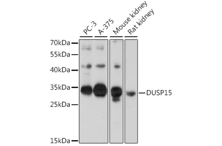 Western Blot - Anti-DUSP15 Antibody (A89256) - Antibodies.com