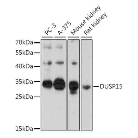 Western Blot - Anti-DUSP15 Antibody (A89256) - Antibodies.com