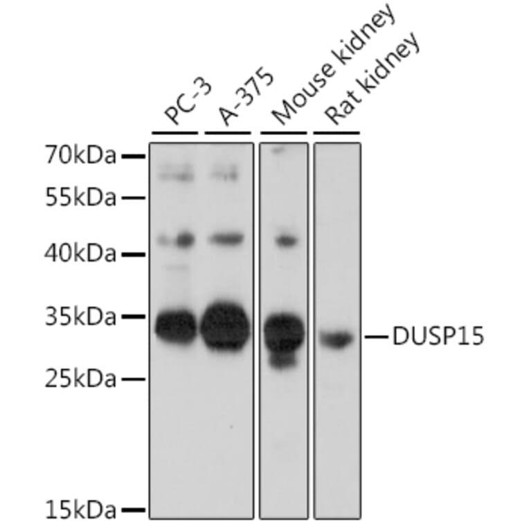 Western Blot - Anti-DUSP15 Antibody (A89256) - Antibodies.com