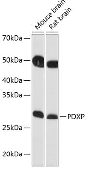 Western blot analysis of extracts of various cell lines, using Anti-PDXP Antibody (A17455) at 1:1,000 dilution.
Secondary antibody: Goat Anti-Rabbit IgG (H+L) (HRP) (AS014) at 1:10,000 dilution.
Lysates / proteins: 25µg per lane.
Blocking buffer: 3% non-fat dry milk in TBST.
Detection: ECL Basic Kit (RM00020).
Exposure time: 90s.