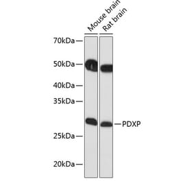 Western Blot - Anti-PDXP Antibody (A89257) - Antibodies.com