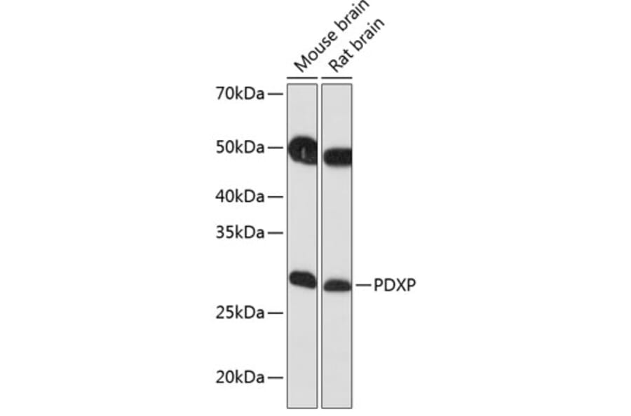 Western Blot - Anti-PDXP Antibody (A89257) - Antibodies.com