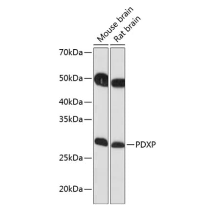 Western Blot - Anti-PDXP Antibody (A89257) - Antibodies.com