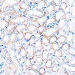 Immunohistochemistry - Anti-PDXP Antibody (A89257) - Antibodies.com