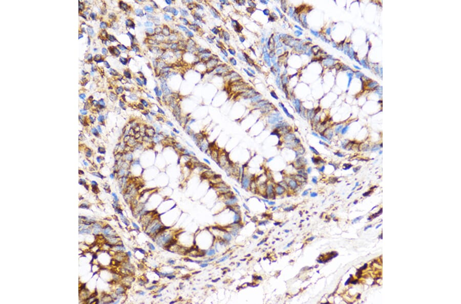 Immunohistochemistry - Anti-PDXP Antibody (A89257) - Antibodies.com