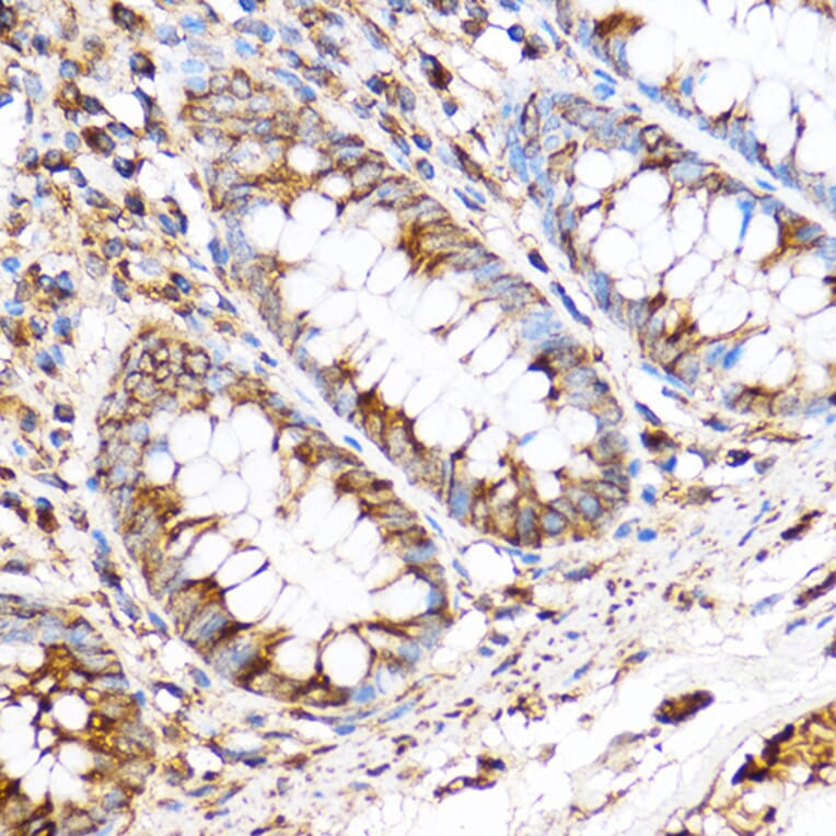 Immunohistochemistry - Anti-PDXP Antibody (A89257) - Antibodies.com