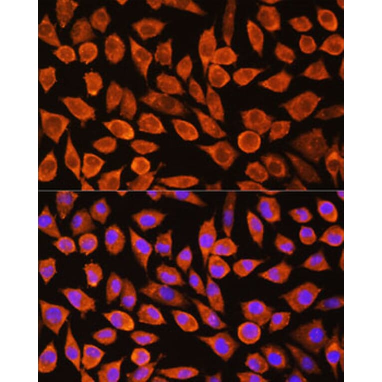 Immunofluorescence - Anti-PDXP Antibody (A89257) - Antibodies.com