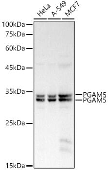 Western blot analysis of extracts of various cell lines, using Anti-PGAM5 Antibody (A16022) at 1:1,000 dilution.
Secondary antibody: Goat Anti-Rabbit IgG (H+L) (HRP) (AS014) at 1:10,000 dilution.
Lysates / proteins: 25µg per lane.
Blocking buffer: 3% non-fat dry milk in TBST.
Detection: ECL Basic Kit (RM00020).
Exposure time: 30s.