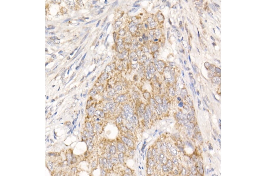 Immunohistochemistry - Anti-PGAM5 Antibody (A89258) - Antibodies.com