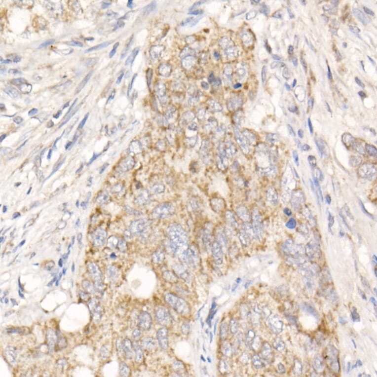 Immunohistochemistry - Anti-PGAM5 Antibody (A89258) - Antibodies.com