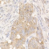 Immunohistochemistry - Anti-PGAM5 Antibody (A89258) - Antibodies.com