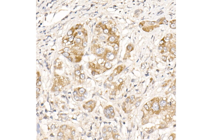 Immunohistochemistry - Anti-PGAM5 Antibody (A89258) - Antibodies.com