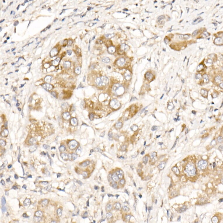 Immunohistochemistry - Anti-PGAM5 Antibody (A89258) - Antibodies.com