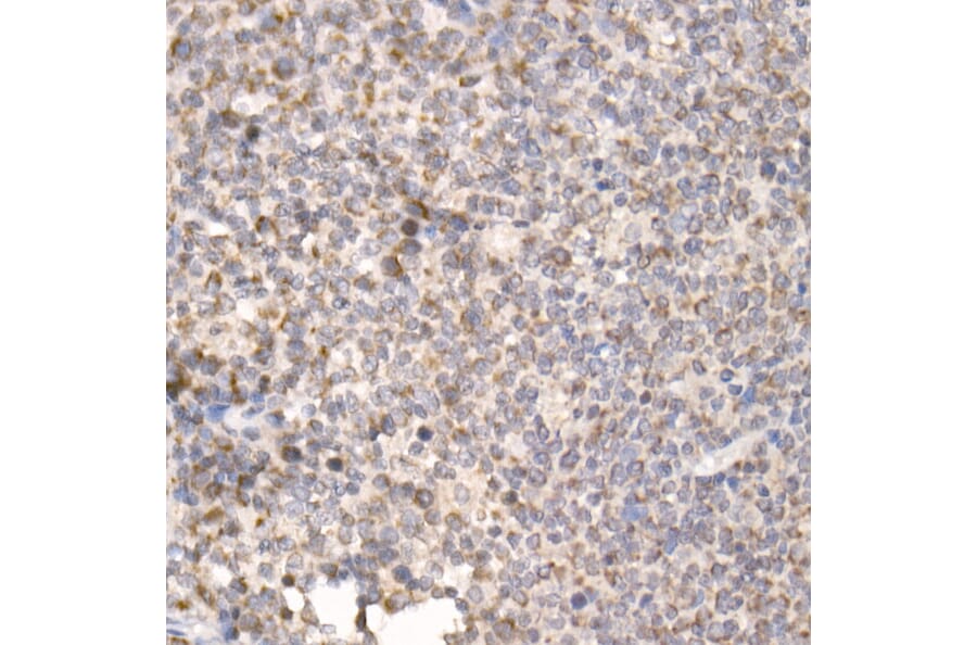 Immunohistochemistry - Anti-PGAM5 Antibody (A89258) - Antibodies.com
