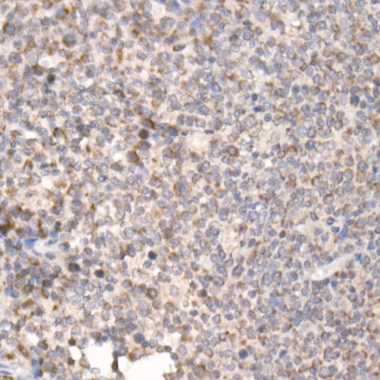 Immunohistochemistry - Anti-PGAM5 Antibody (A89258) - Antibodies.com
