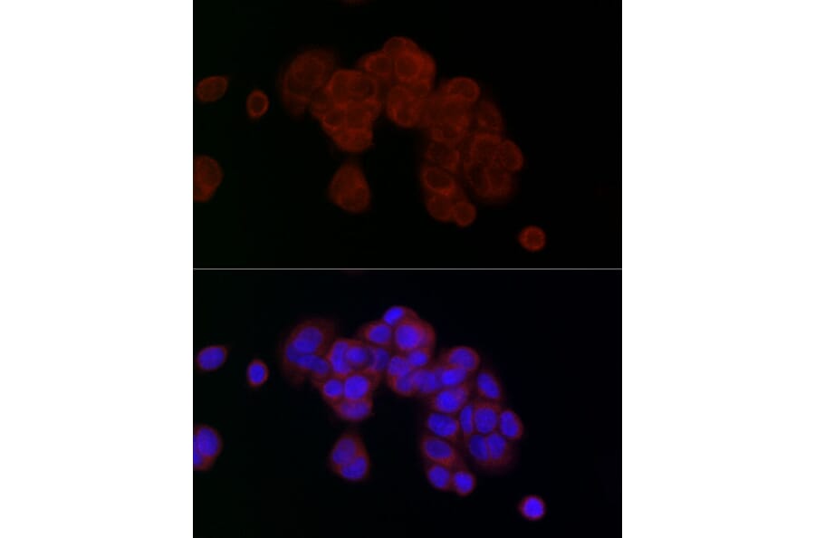 Immunofluorescence - Anti-PGAM5 Antibody (A89258) - Antibodies.com