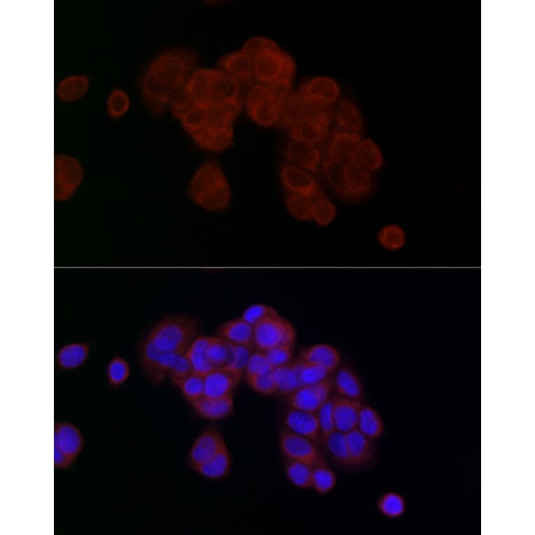 Immunofluorescence - Anti-PGAM5 Antibody (A89258) - Antibodies.com
