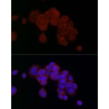 Immunofluorescence - Anti-PGAM5 Antibody (A89258) - Antibodies.com