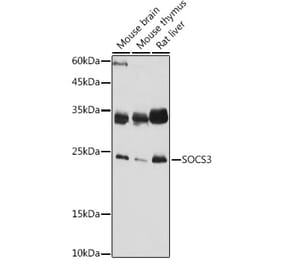 Western Blot - Anti-SOCS3 Antibody (A89259) - Antibodies.com