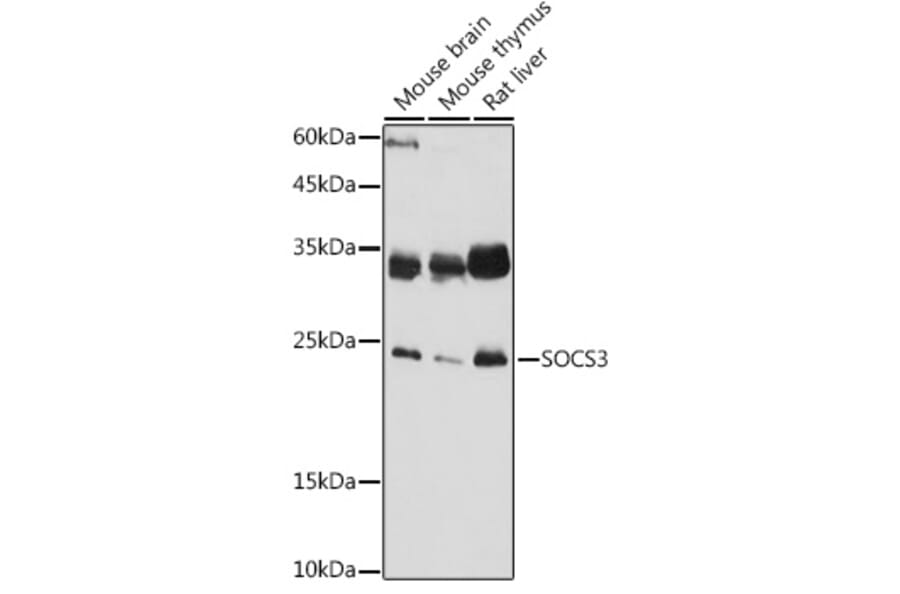 Western Blot - Anti-SOCS3 Antibody (A89259) - Antibodies.com