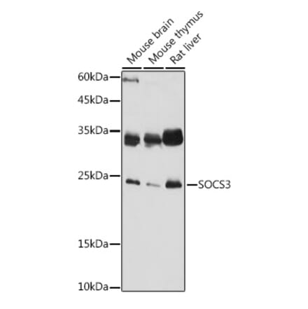 Western Blot - Anti-SOCS3 Antibody (A89259) - Antibodies.com