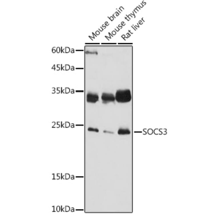 Western Blot - Anti-SOCS3 Antibody (A89259) - Antibodies.com