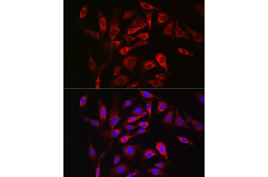 Immunofluorescence - Anti-SOCS3 Antibody (A89259) - Antibodies.com