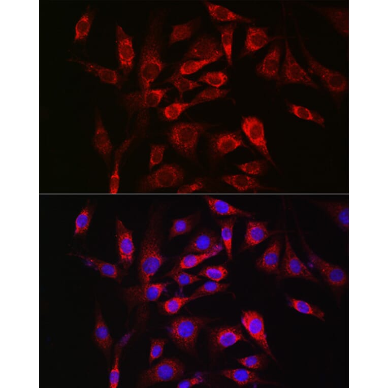 Immunofluorescence - Anti-SOCS3 Antibody (A89259) - Antibodies.com