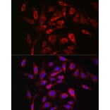 Immunofluorescence - Anti-SOCS3 Antibody (A89259) - Antibodies.com