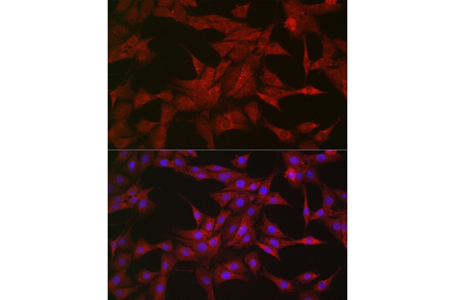 Immunofluorescence - Anti-SOCS3 Antibody (A89259) - Antibodies.com