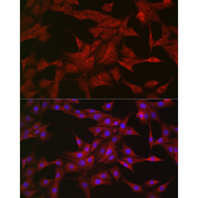 Immunofluorescence - Anti-SOCS3 Antibody (A89259) - Antibodies.com