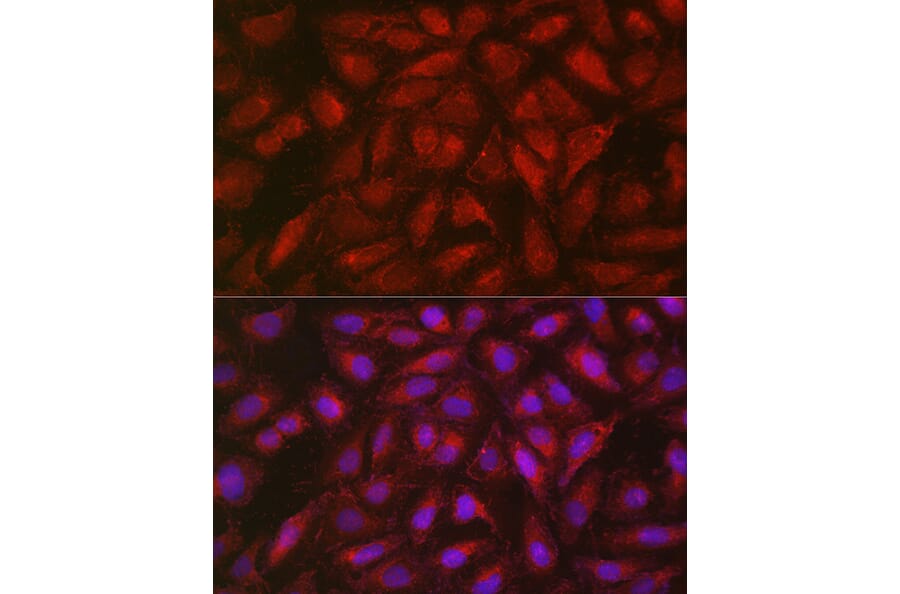Immunofluorescence - Anti-SOCS3 Antibody (A89259) - Antibodies.com