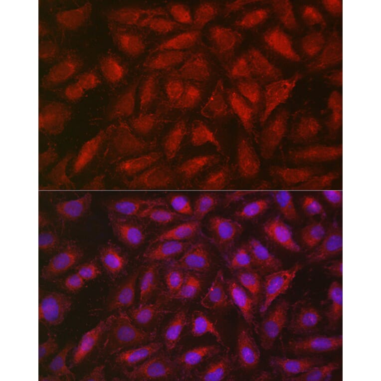 Immunofluorescence - Anti-SOCS3 Antibody (A89259) - Antibodies.com