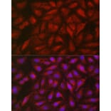 Immunofluorescence - Anti-SOCS3 Antibody (A89259) - Antibodies.com