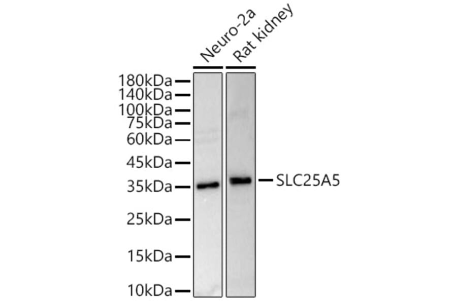 Western Blot - Anti-Adenine Nucleotide Translocator 2/ANT 2 Antibody (A89260) - Antibodies.com