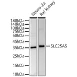 Western Blot - Anti-Adenine Nucleotide Translocator 2/ANT 2 Antibody (A89260) - Antibodies.com