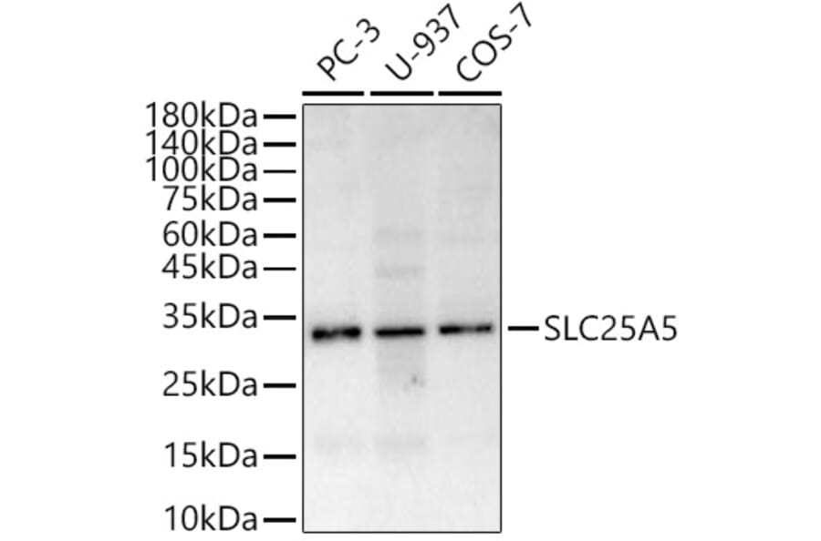 Western Blot - Anti-Adenine Nucleotide Translocator 2/ANT 2 Antibody (A89260) - Antibodies.com
