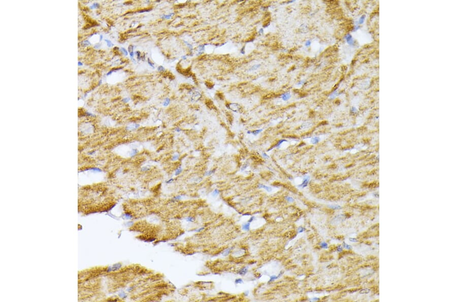 Immunohistochemistry - Anti-Adenine Nucleotide Translocator 2/ANT 2 Antibody (A89260) - Antibodies.com