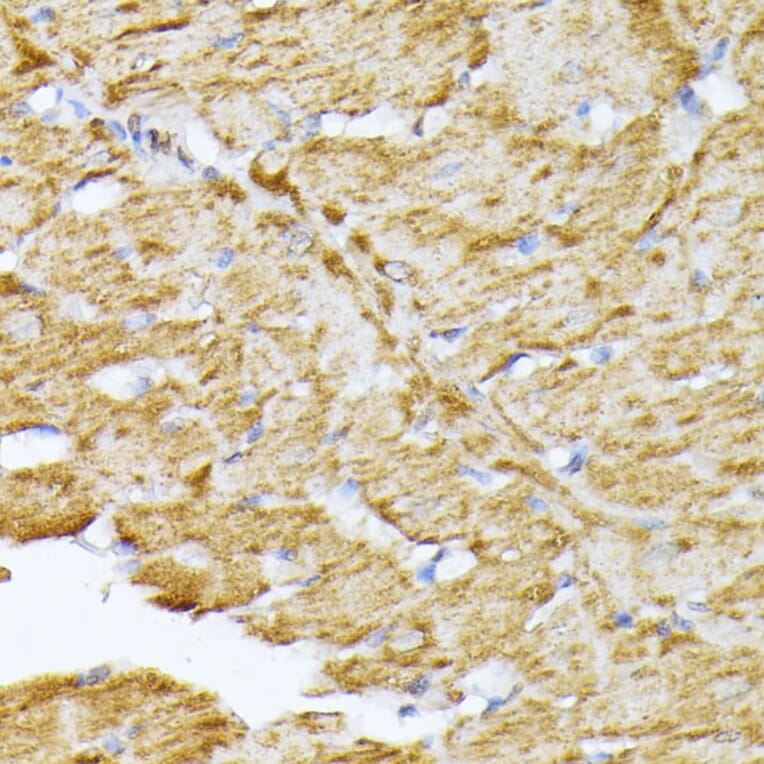 Immunohistochemistry - Anti-Adenine Nucleotide Translocator 2/ANT 2 Antibody (A89260) - Antibodies.com