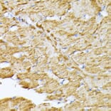 Immunohistochemistry - Anti-Adenine Nucleotide Translocator 2/ANT 2 Antibody (A89260) - Antibodies.com