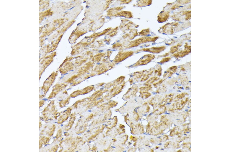 Immunohistochemistry - Anti-Adenine Nucleotide Translocator 2/ANT 2 Antibody (A89260) - Antibodies.com