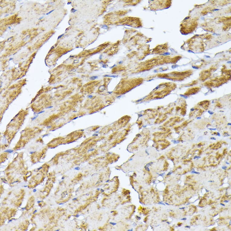 Immunohistochemistry - Anti-Adenine Nucleotide Translocator 2/ANT 2 Antibody (A89260) - Antibodies.com