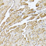 Immunohistochemistry - Anti-Adenine Nucleotide Translocator 2/ANT 2 Antibody (A89260) - Antibodies.com