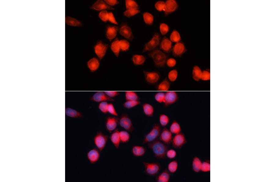 Immunofluorescence - Anti-Adenine Nucleotide Translocator 2/ANT 2 Antibody (A89260) - Antibodies.com