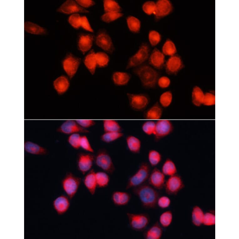 Immunofluorescence - Anti-Adenine Nucleotide Translocator 2/ANT 2 Antibody (A89260) - Antibodies.com