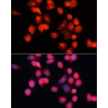 Immunofluorescence - Anti-Adenine Nucleotide Translocator 2/ANT 2 Antibody (A89260) - Antibodies.com